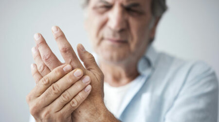 A primer on rheumatoid arthritis