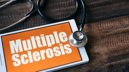 7 things to know about multiple sclerosis