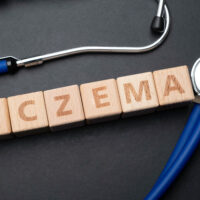 An A to Z guide on eczema