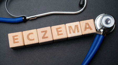 An A to Z guide on eczema