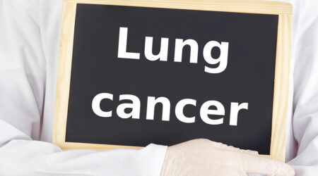 Crucial aspects to know about lung cancer