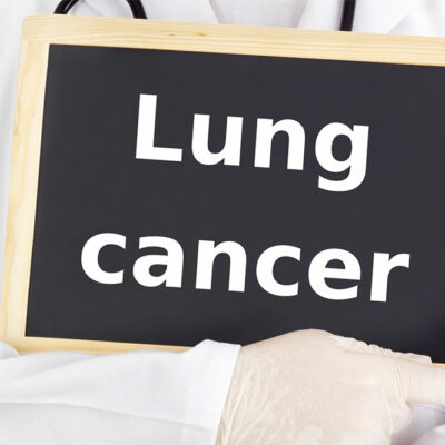 Crucial aspects to know about lung cancer