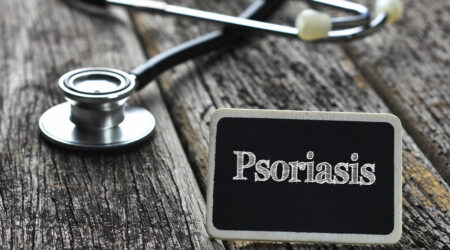 Plaque psoriasis &#8211; Causes, symptoms, diagnosis, and treatments