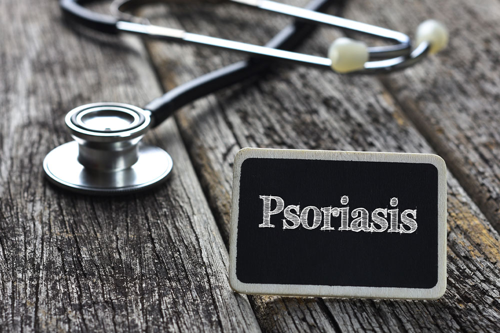 Plaque psoriasis &#8211; Causes, symptoms, diagnosis, and treatments