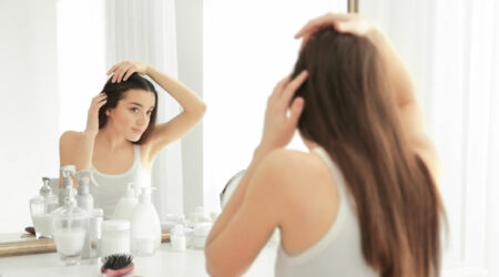 Things you need to know about scalp psoriasis