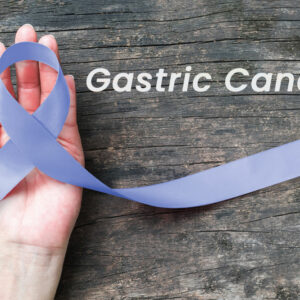 Essential factors that are related to gastric cancer