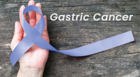 Essential factors that are related to gastric cancer