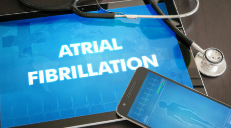 A comprehensive understanding of atrial fibrillation