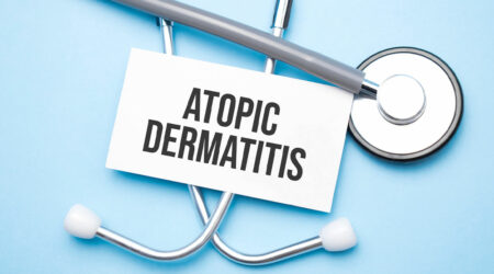 Atopic dermatitis home remedies, management options, and best foods