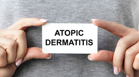 Signs, symptoms, and causes of atopic dermatitis