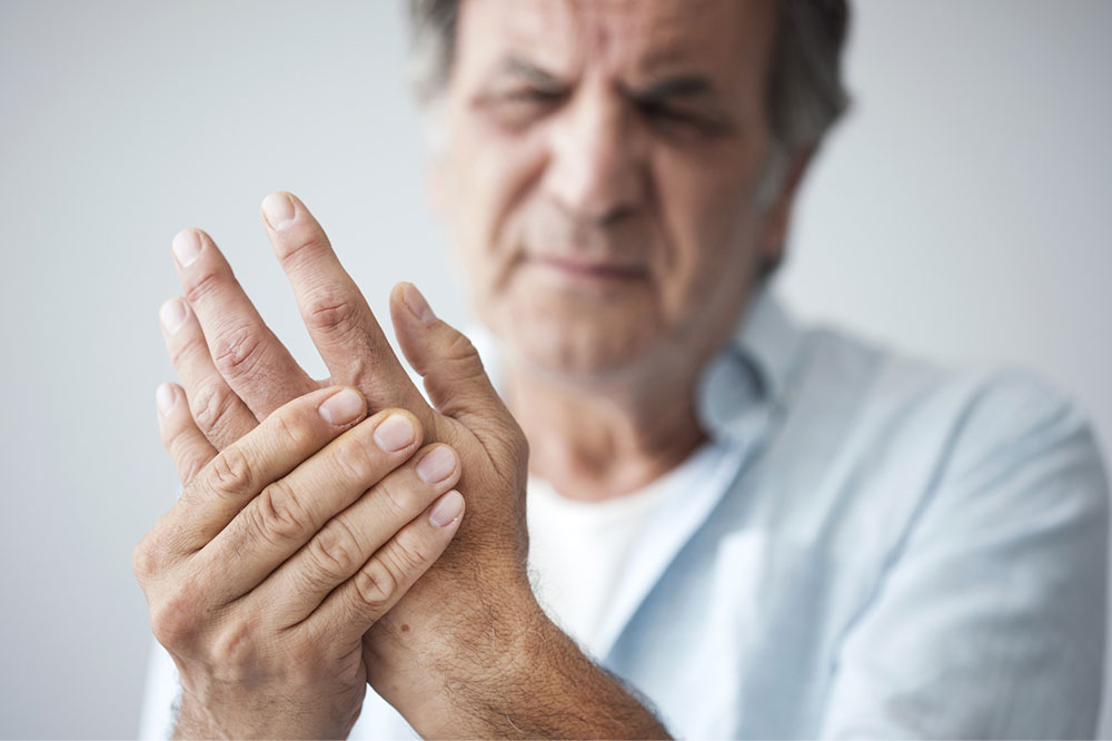 A primer on rheumatoid arthritis