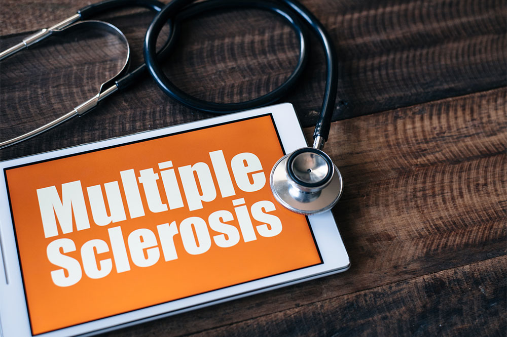 7 things to know about multiple sclerosis