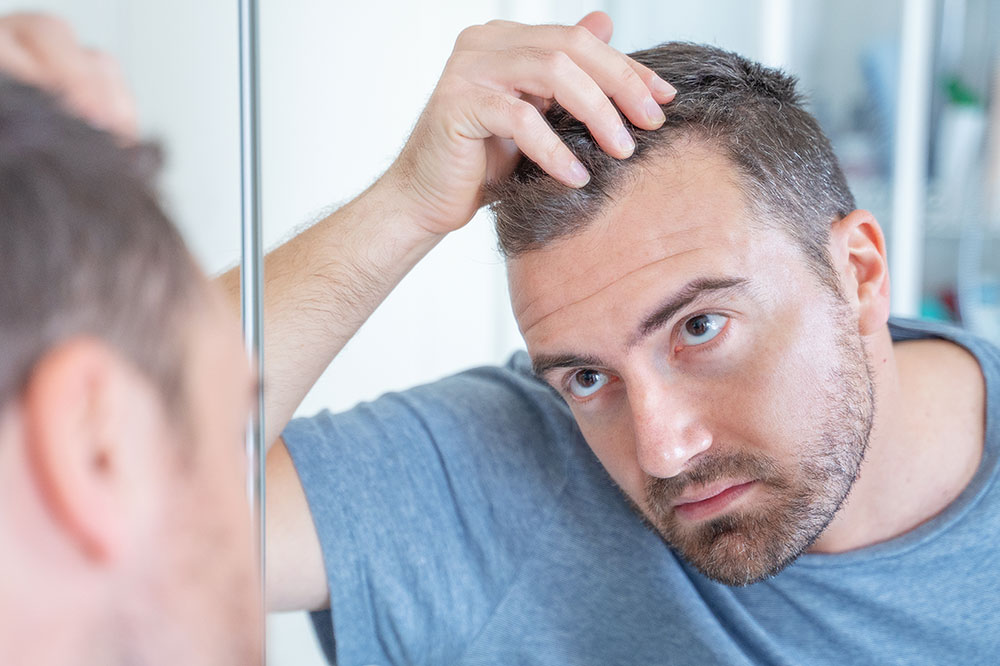 A handy guide on scalp psoriasis