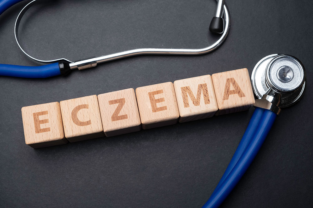 An A to Z guide on eczema