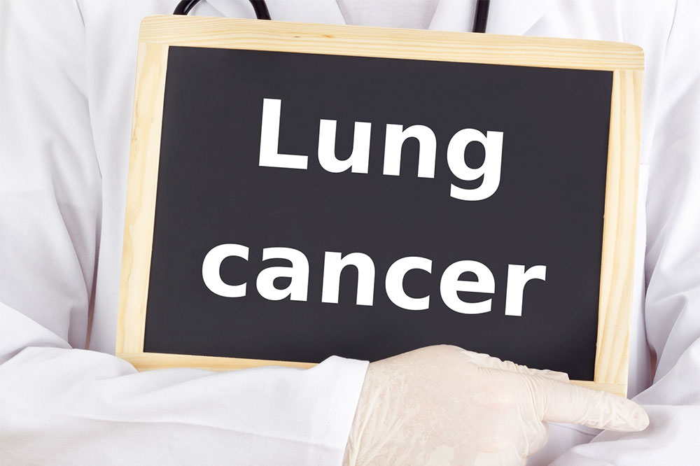 Crucial aspects to know about lung cancer