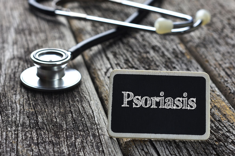 Plaque psoriasis – Causes, symptoms, diagnosis, and treatments