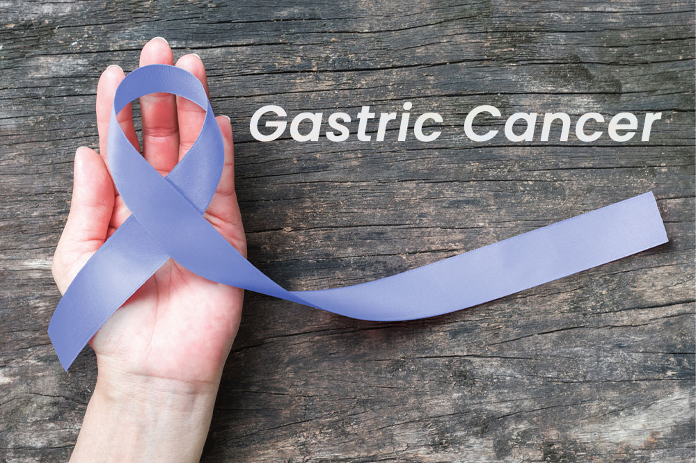 Essential factors that are related to gastric cancer