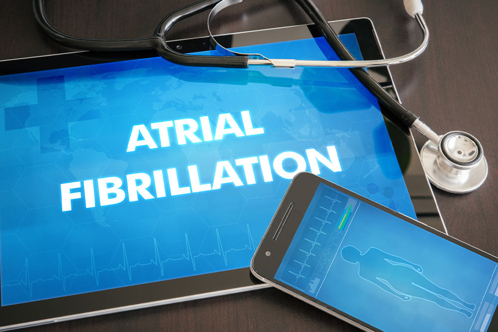 A comprehensive understanding of atrial fibrillation