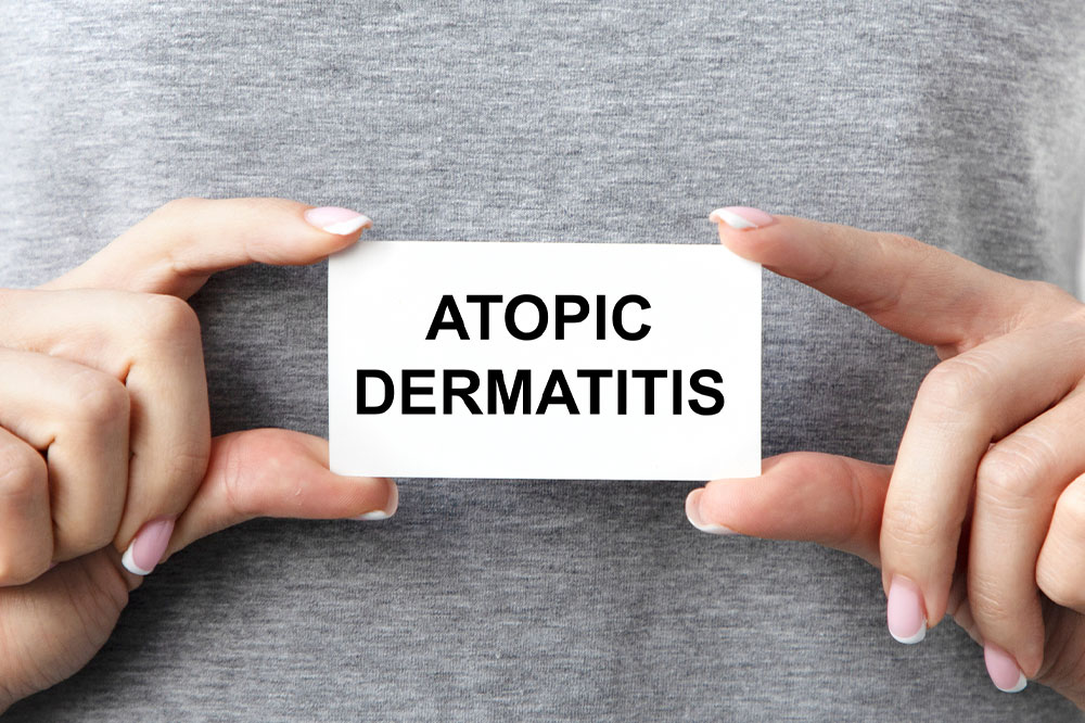 Signs, symptoms, and causes of atopic dermatitis